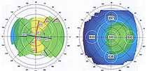 orbscan3